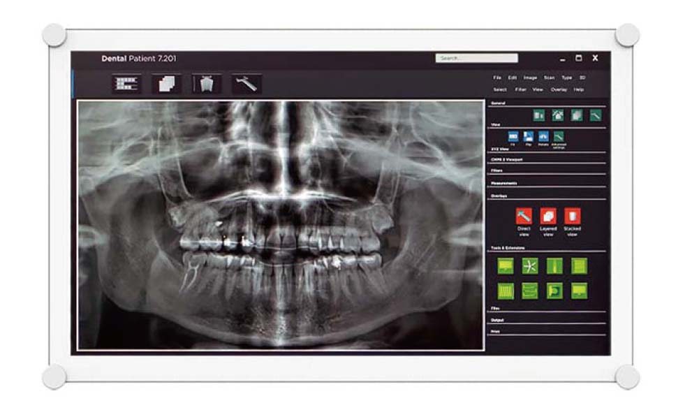 BF-D2200歯科用液晶モニター